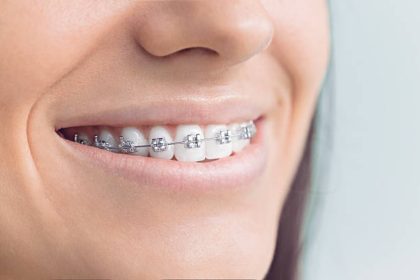 Best Invisalign and Clear Aligners  in Cecil Bishop, PA